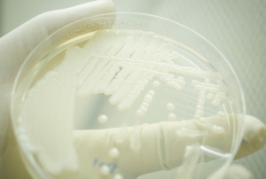 Cells on a petri dish