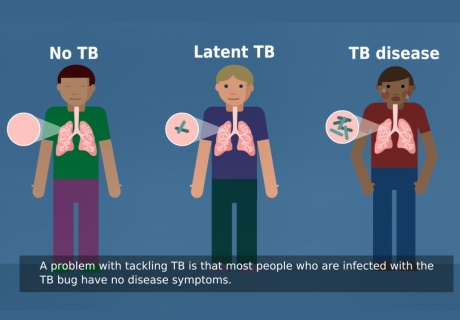 Cartoon of 3 people with TB