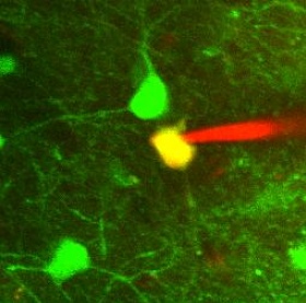 A ‘patched’ neuron: Green shows the fluorescent protein used to guide the robot. Red shows the fluorescent dye inside the pipette. Yellow shows the patched cell.