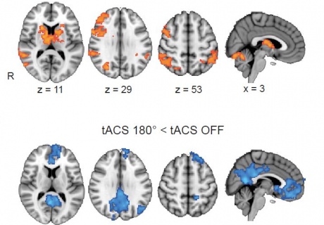 Brain scans showing different areas lighting up