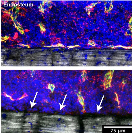 Two images of bone marrow environments