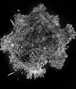 Detail of the actin filaments inside an NK cell which can only be seen using the super-resolution microscope
