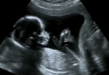 Choice of monitoring method could be key for babies with poor growth in the womb