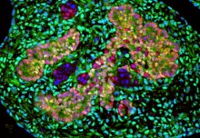 Pancreas cells' genetic instructions open doors to diabetes treatment