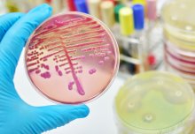 &pound;14m EU project to aid meningitis diagnosis and cut antibiotic use