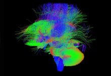 Newborn baby brain scans will help scientists track brain development