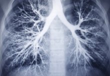 Nano-sized drug carriers could be the future for patients with lung disease