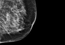 Research collaboration aims to improve breast cancer diagnosis using AI