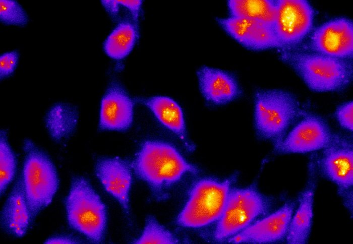 A radioactive tracer reveals dormant cancer cells by highlighting energy stores called glycogen.