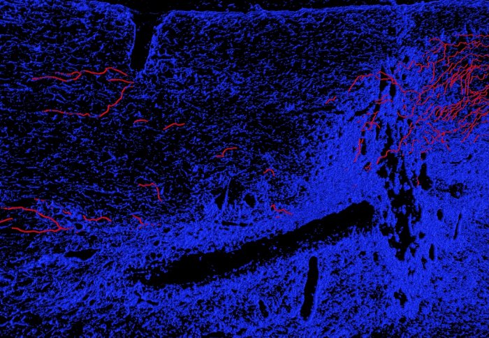 Regenerating axons CNS