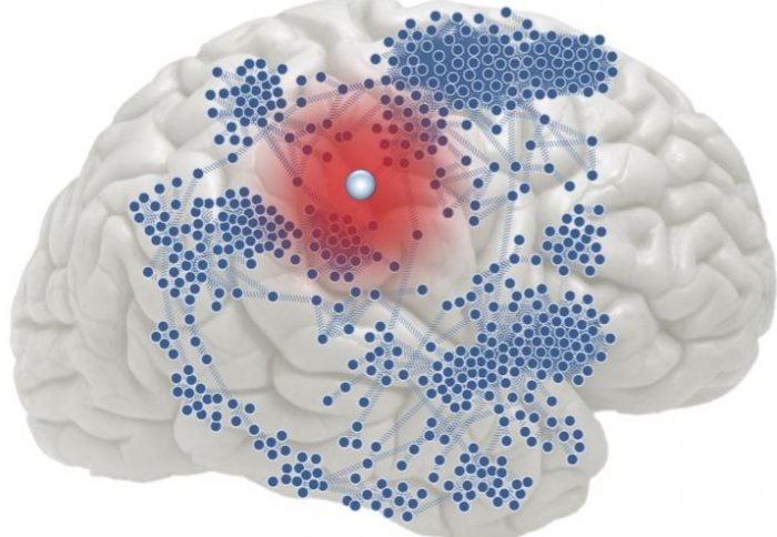 ep brain network