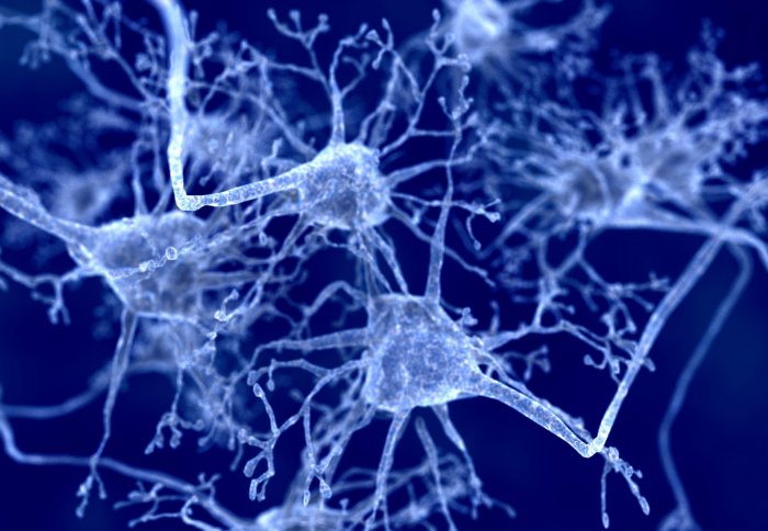 Tangle of neurons
