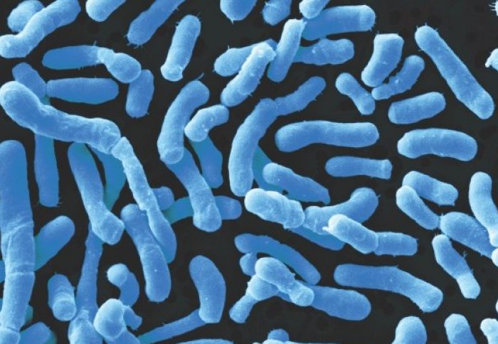 40 бактерий. Бифидо и лактобактерии под микроскопом. Bifidobacterium bifidum. Ацидофильные лактобактерии (Lactobacillus Acidophilus). Мезофильные молочнокислые бактерии.