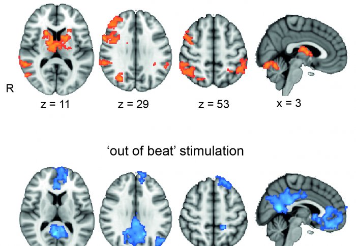 Brain scans showing activity of brain waves as a heat map