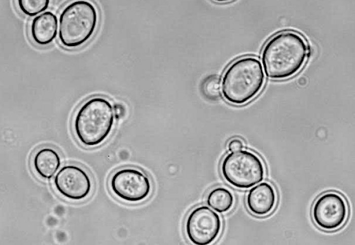 Yeast cells