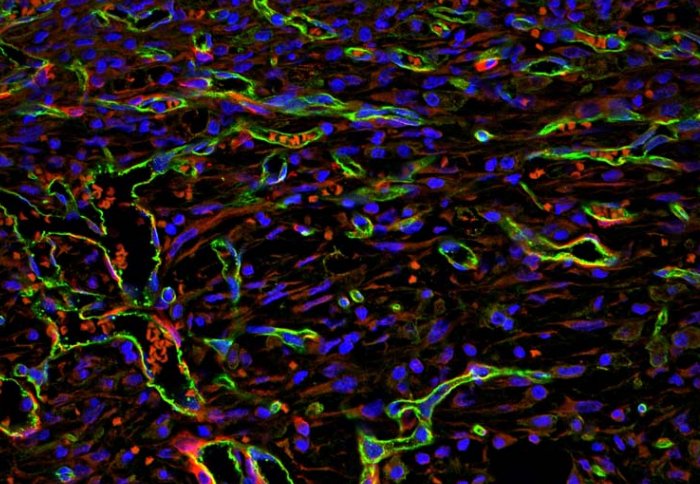 Colourful microscope image of blood vessel growth in healing wound tissue