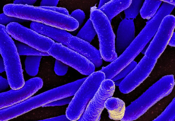 Basic building blocks of bacterial 'hair' could lead to new antibiotics |  Imperial News | Imperial College London