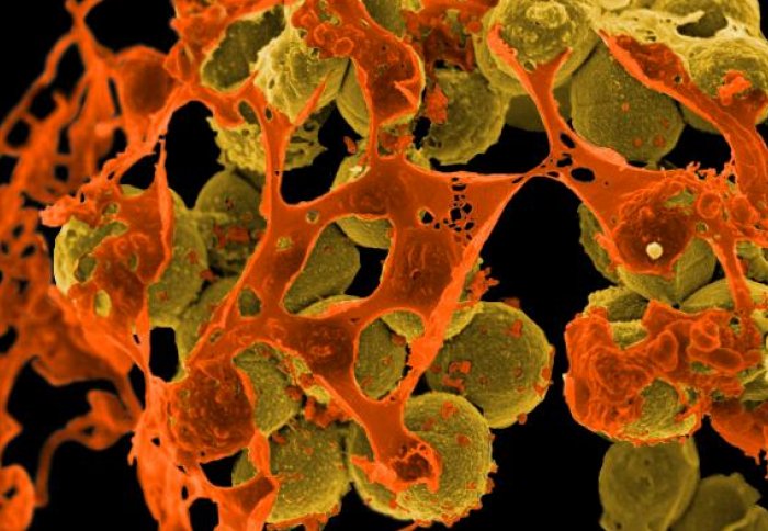 The MRC CMBI's research includes finding out how the 'superbug' MRSA (pictured) evades antibiotics