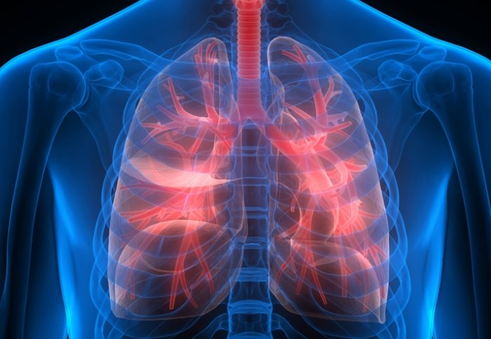 Lung disease