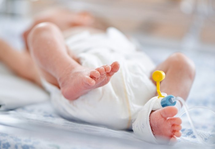 A premature baby in an incubator