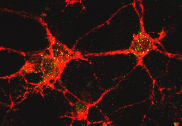 Red stringy cells with small green inclusions