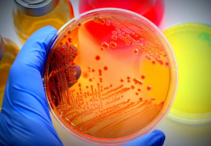 E.coli drug resistance threatens the efficacy of common antibiotic treatments