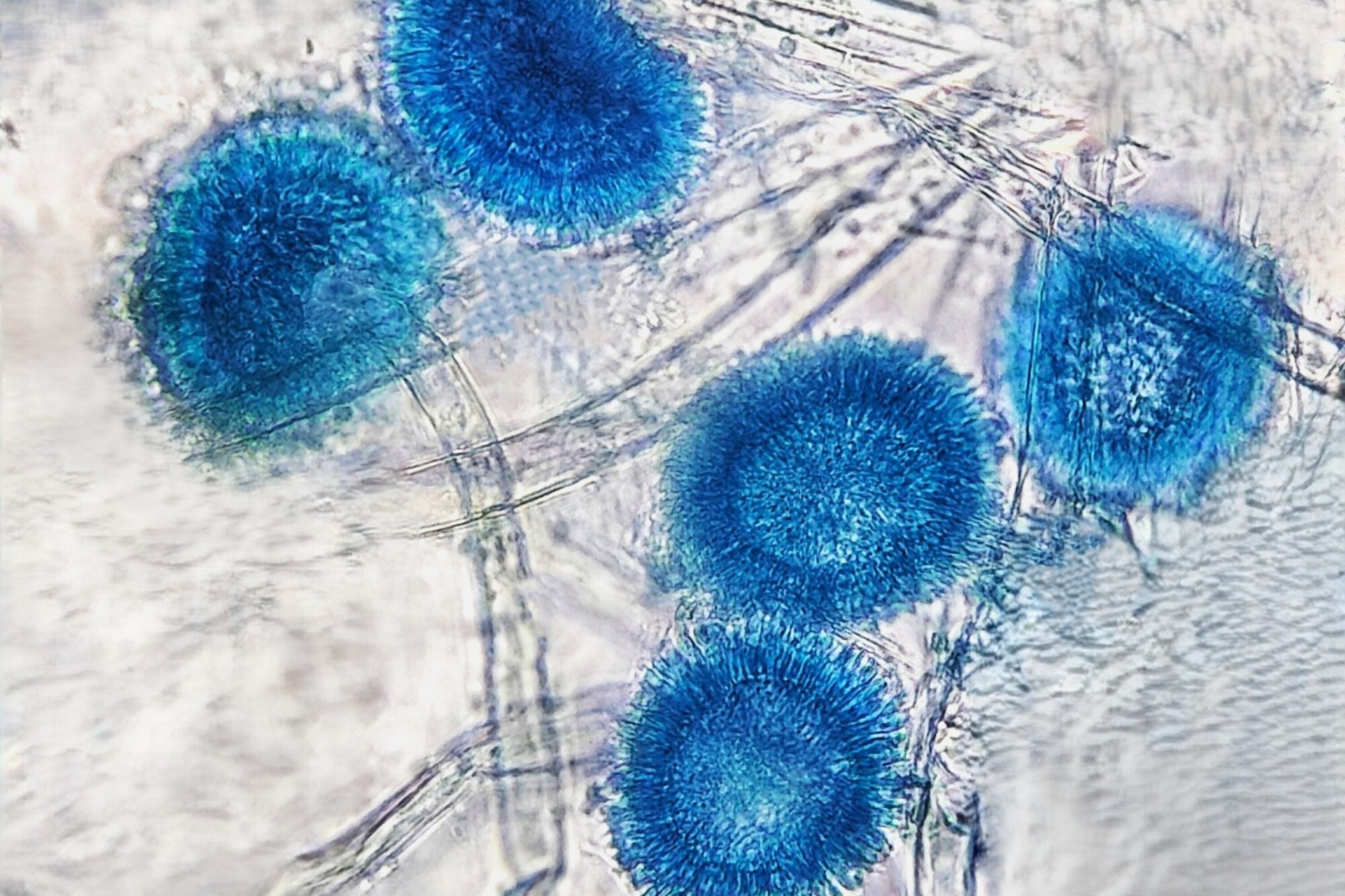 A microscopic view of Aspergillus flavus.