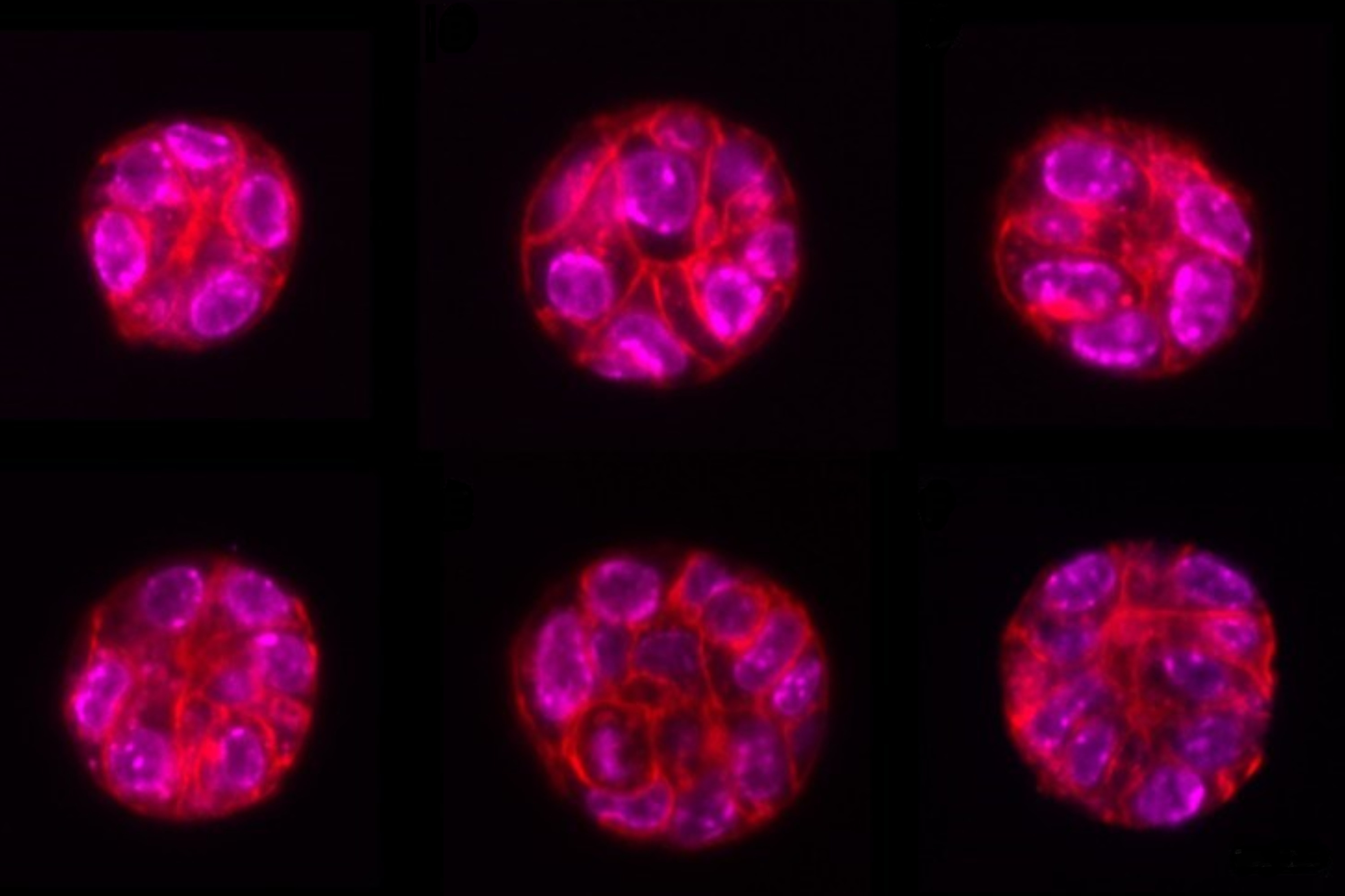 Organoids under oblique plane microscopy