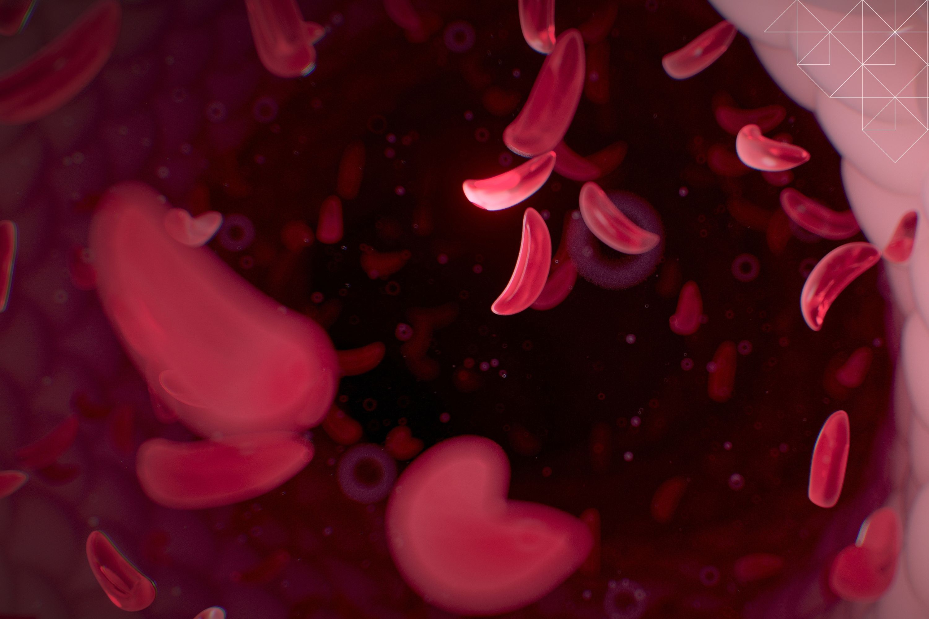 Photo: imperial.ac.uk Sickle cell care research