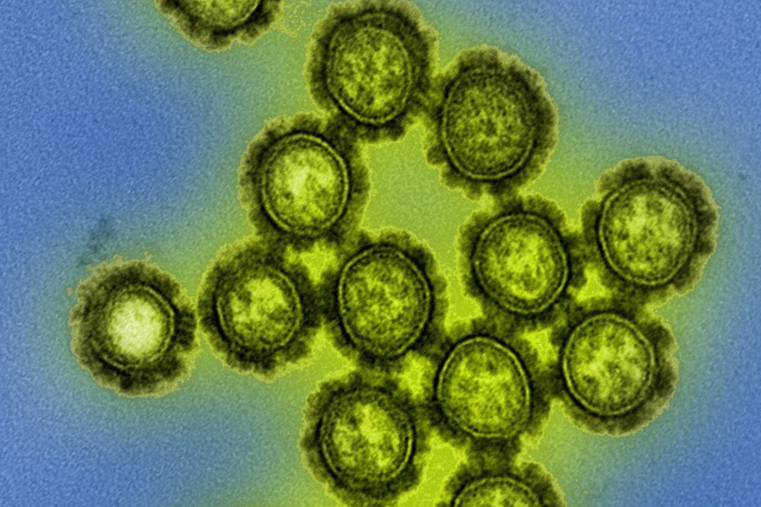 Image of bacteria under a microscope