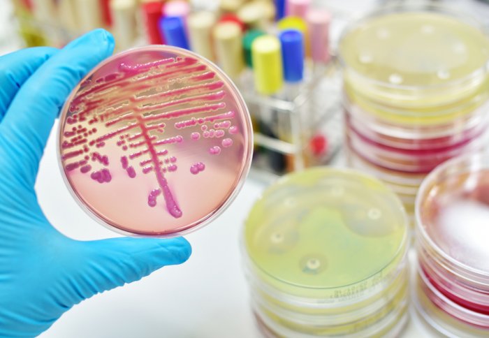 The new test could mean doctors no longer need to wait to grow bacteria to diagnose an infection 