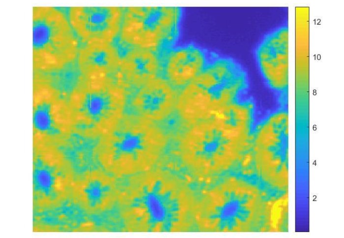 FTIR spectroscopic imaging of colon tissue