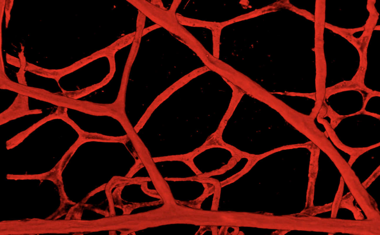 blood vessels