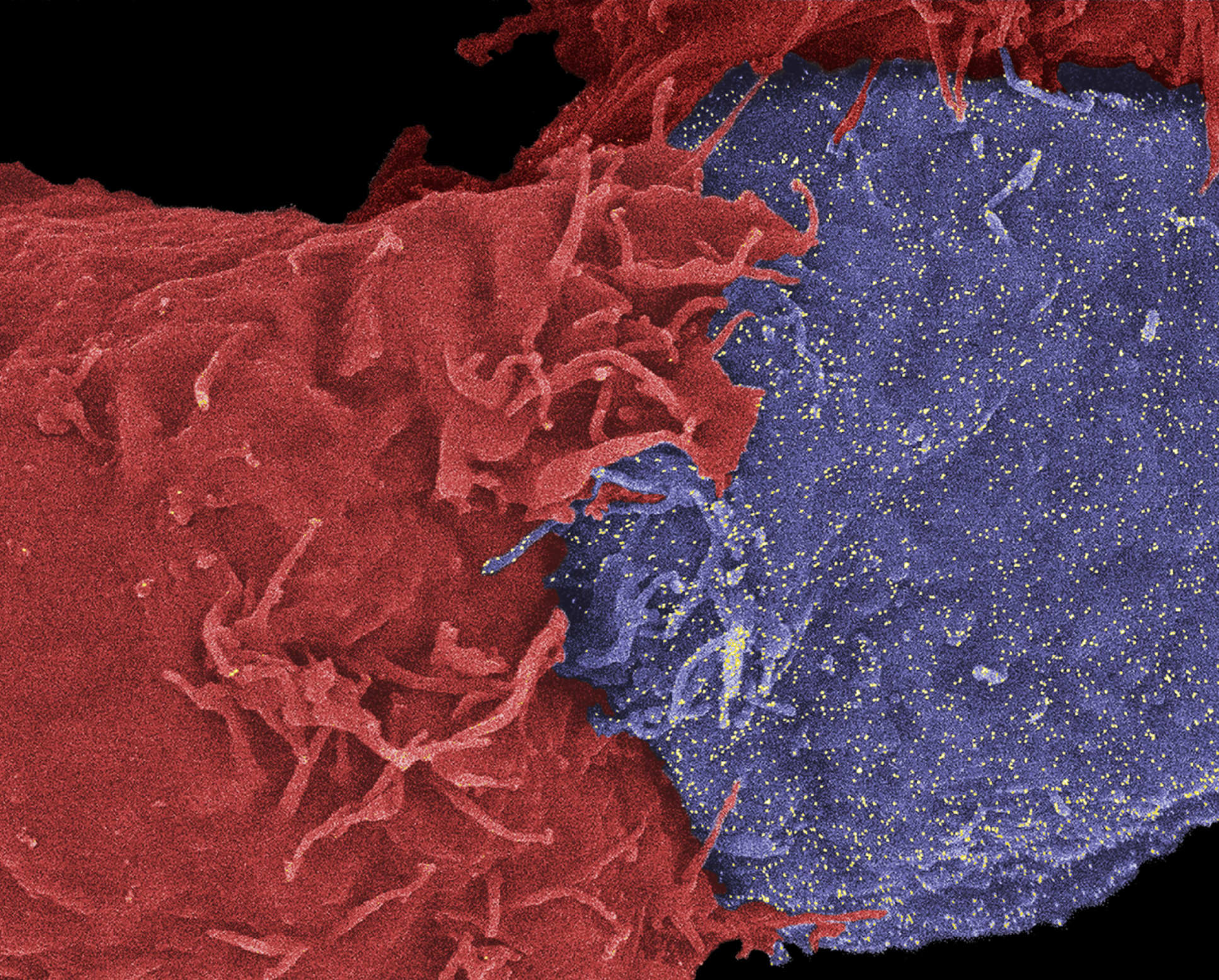 Natural Killer cell attacking cancer cell 