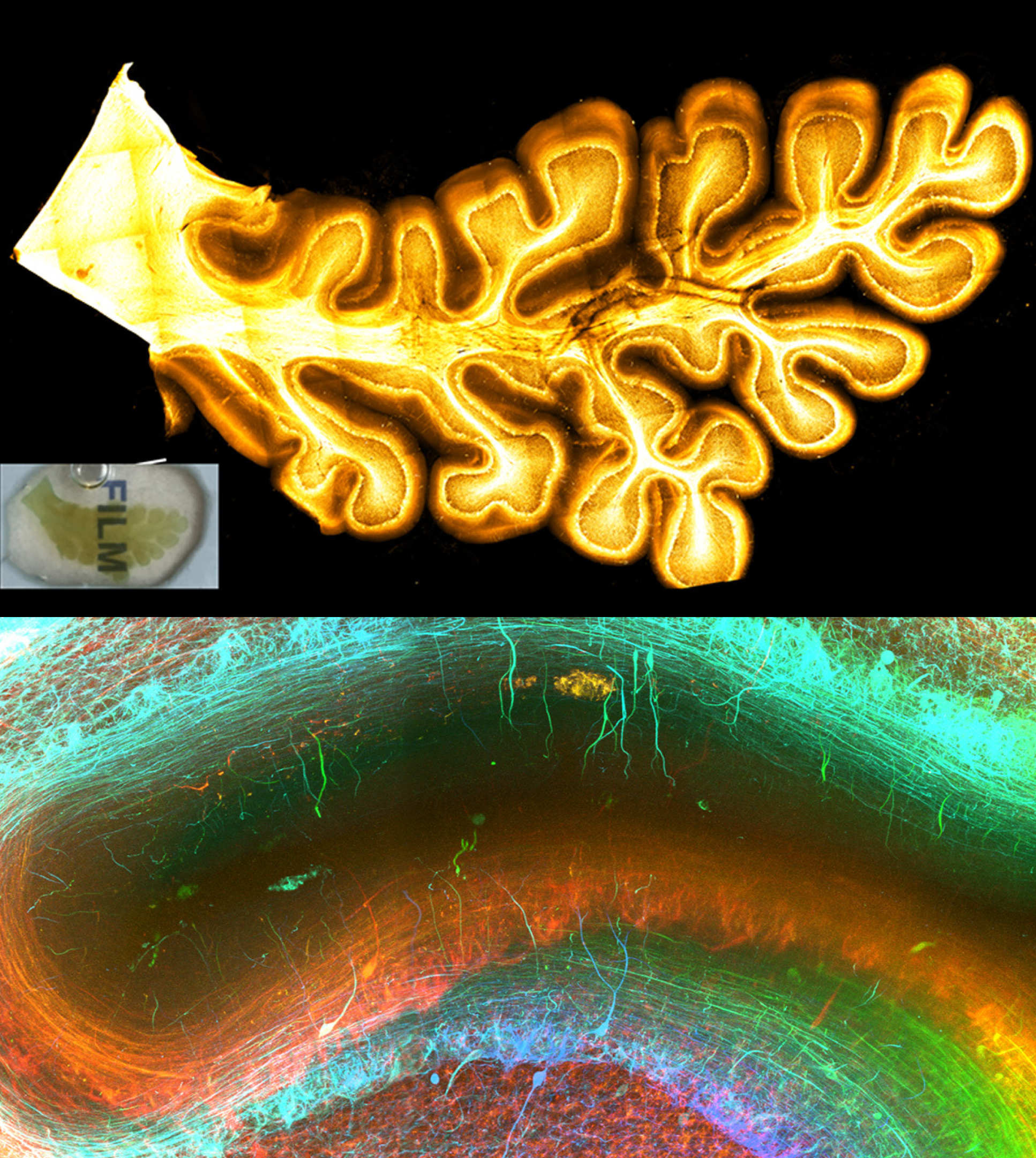 New tissue technique gives stunning 3D insights into the human