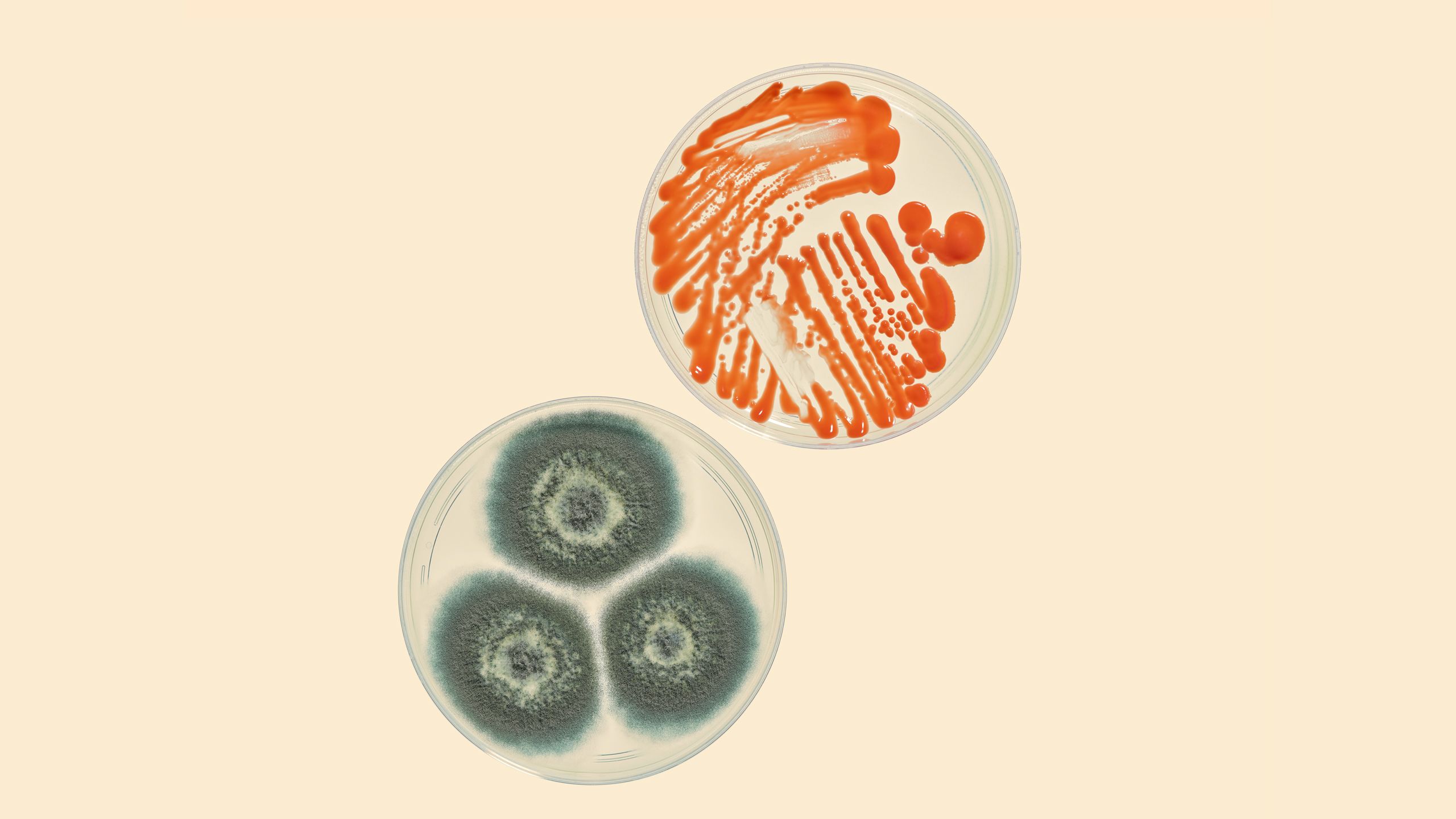 Petri dishes showing the moulds rhodotorula glutinis and aspergillus fumigatus