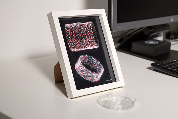 3D model of blood vessel