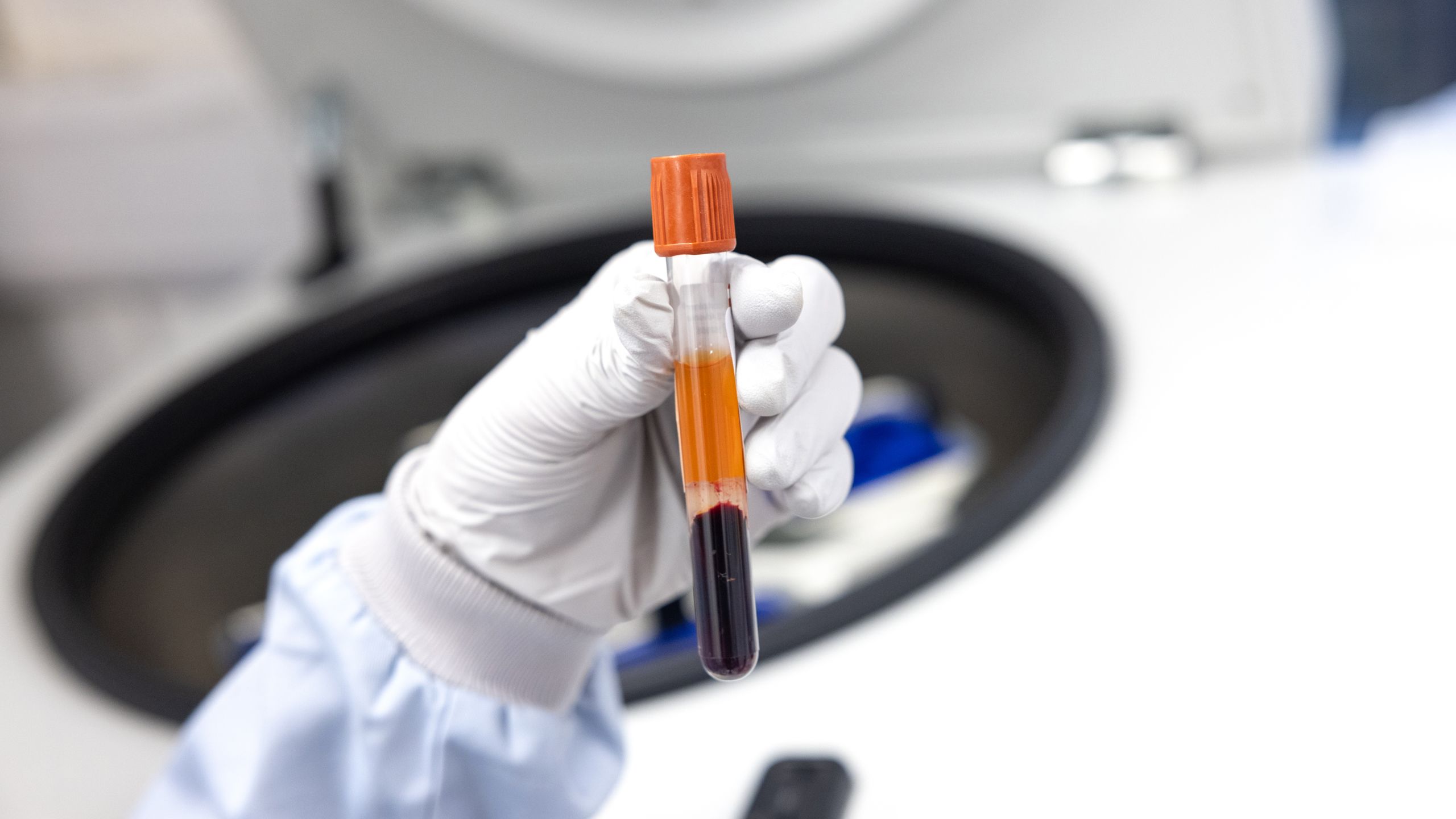 A vial of blood for testing COVID-19 antibodies